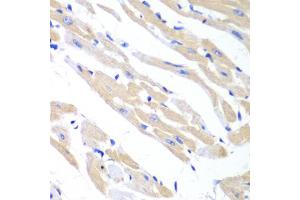 Immunohistochemistry of paraffin-embedded mouse heart using TRIM21 antibody. (TRIM21 antibody)