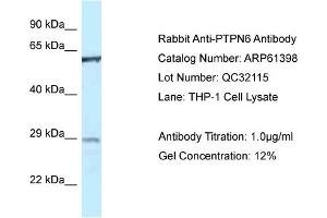 Western Blotting (WB) image for anti-Protein-tyrosine Phosphatase 1C (PTPN6) (Middle Region) antibody (ABIN2788789) (SHP1 antibody  (Middle Region))