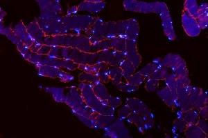 IF analysis of MG53/TRIM72 using anti-MG53/TRIM72 antibody (ABIN7601079).