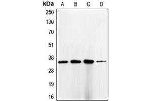 Western blot analysis of CDC2 expression in HeLa (A), K562 (B), MCF7 (C), A431 (D) whole cell lysates. (CDK1 antibody  (Center))