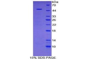 SDS-PAGE analysis of Rat PRG2 Protein. (Major Basic Protein Protein)