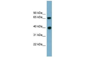 WB Suggested Anti-CCNJ Antibody Titration: 0. (Cyclin J antibody  (N-Term))