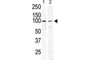 Western Blotting (WB) image for anti-Mast/stem Cell Growth Factor Receptor (KIT) antibody (ABIN5014921) (KIT antibody)