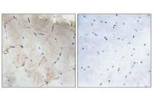 Immunohistochemistry analysis of paraffin-embedded human skeletal muscle tissue using Collagen XII α1 antibody. (COL12A1 antibody)