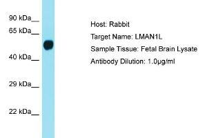Host: Rabbit Target Name: LMAN1L Sample Tissue: Human Fetal Brain Antibody Dilution: 1ug/ml (LMAN1L antibody  (Middle Region))
