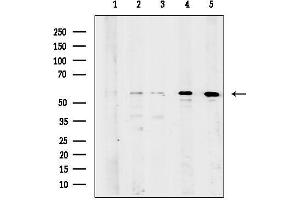 anti-Katanin P60 (ATPase Containing) Subunit A 1 (KATNA1) (C-Term) antibody