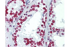 Anti-SAE1 antibody IHC staining of human prostate. (SAE1 antibody)