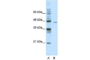 WB Suggested Anti-DDX25  Antibody Titration: 0. (DDX25 antibody  (C-Term))
