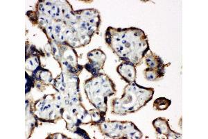 Immunohistochemistry (IHC) image for anti-Eukaryotic Translation Initiation Factor 2 Subunit 1 (EIF2S1) (AA 123-137), (Middle Region) antibody (ABIN3044058)