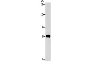 Gel: 8 % SDS-PAGE, Lysate: 40 μg, Lane: Human lymphoma tissue, Primary antibody: ABIN7190422(CYP46A1 Antibody) at dilution 1/200, Secondary antibody: Goat anti rabbit IgG at 1/8000 dilution, Exposure time: 1 minute