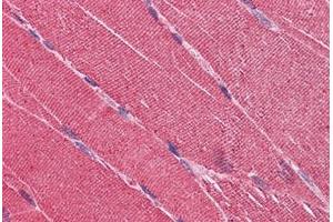 Human Skeletal Muscle: Formalin-Fixed, Paraffin-Embedded (FFPE) (EDEM2 antibody  (AA 479-579))