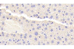 Detection of TNIP2 in Mouse Liver Tissue using Polyclonal Antibody to Tumor Necrosis Factor Alpha Induced Protein 3 Interacting Protein 2 (TNIP2) (TNIP2 antibody  (AA 170-413))