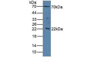 Figure. (IL1RAP antibody  (AA 420-558))