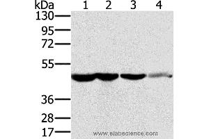 Western blot analysis of HT-29 cell and human normal kidney tissue, Lo2 cell and human normal liver tissue, human fetal brain tissue, using RNH1 Polyclonal Antibody at dilution of 1:400 (RNH1 antibody)