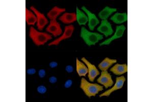 eIF2B epsilon Mouse Monoclonal Antibody staining HepG2 cells by IF/ICC.
