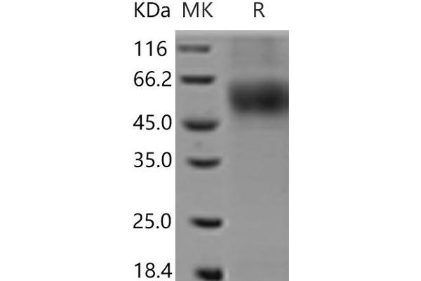 Macrophage Scavenger Receptor 1 Protein (MSR1) (His tag)