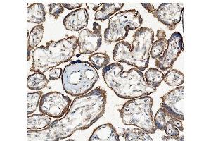 IHC analysis of Hexokinase 1/HK1 using anti-Hexokinase 1/HK1 antibody (ABIN7600259). (Hexokinase 1 antibody  (AA 17-323))