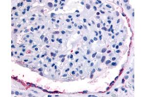 Anti-EPHA4 antibody IHC of human kidney, glomerulus.