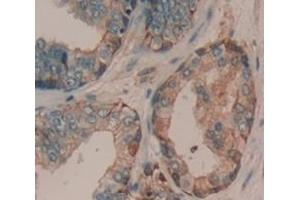 #VALUE! (ADAMTS16 antibody  (AA 290-641))