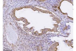 IHC analysis of PMPCB using anti-PMPCB antibody (ABIN7600757).