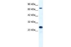 WB Suggested Anti-MCM6 Antibody Titration:  1. (MCM6 antibody  (C-Term))