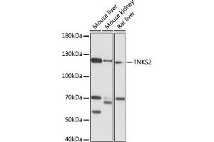 Western blot analysis of extracts of various cell lines, using TNKS2 antibody (ABIN7270726) at 1:1000 dilution. (TNKS2 antibody  (AA 780-1050))