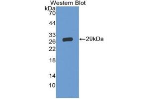Western blot analysis of the recombinant protein. (GP5 antibody  (AA 17-242))