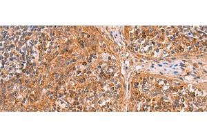 Immunohistochemistry of paraffin-embedded Human tonsil tissue using CREBBP Polyclonal Antibody at dilution of 1:35(x200) (CBP antibody)