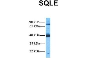 Western Blotting (WB) image for anti-Squalene Epoxidase (SQLE) (C-Term) antibody (ABIN2777142)