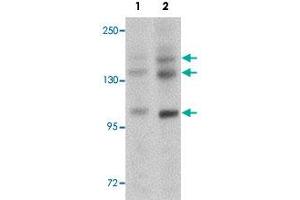 Western blot analysis of rat brain tissue with PRDM16 polyclonal antibody  at (Lane 1) 1 and (Lane 2) 2 ug/mL dilution. (PRDM16 antibody  (C-Term))