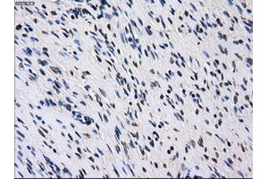Immunohistochemical staining of paraffin-embedded colon tissue using anti-ID3mouse monoclonal antibody. (ID3 antibody)
