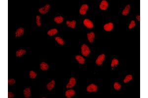 Immunofluorescence (IF) image for anti-Bromodomain Containing 2 (BRD2) (AA 675-725) antibody (ABIN7448918)