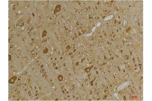 Immunohistochemistry (IHC) analysis of paraffin-embedded Rat Brain Tissue using GABA A Receptor gamma2 Rabbit Polyclonal Antibody diluted at 1:200. (GABRG2 antibody)