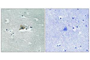 Immunohistochemistry (IHC) image for anti-Claudin 5 (CLDN5) (pTyr217) antibody (ABIN1847755) (Claudin 5 antibody  (pTyr217))