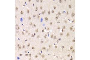 Immunohistochemistry of paraffin-embedded mouse brain using PRPF3 Antibody. (PRPF3 antibody  (AA 1-280))