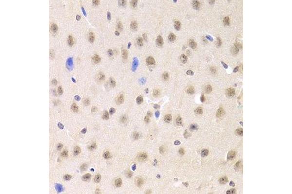 PRPF3 antibody  (AA 1-280)