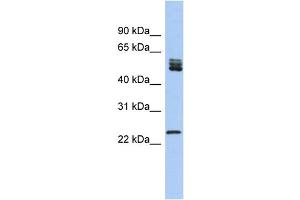 WB Suggested Anti-SFRS7 Antibody Titration: 0.