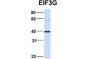 Western Blotting (WB) image for anti-Eukaryotic Translation Initiation Factor 3, Subunit G (EIF3G) (Middle Region) antibody (ABIN2778865)