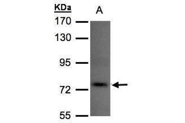 TLK1 antibody