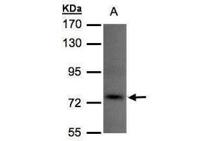 WB Image Sample(30 μg of whole cell lysate) A:293T 7. (TLK1 antibody)