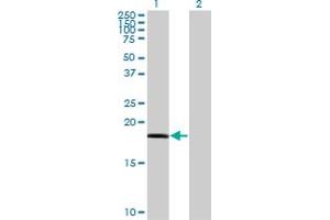 Western Blot analysis of RARRES3 expression in transfected 293T cell line by RARRES3 monoclonal antibody (M10), clone 1H5. (RARRES3 antibody  (AA 1-164))