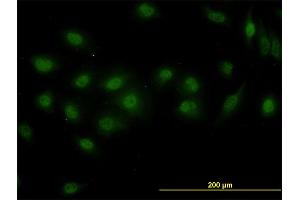 Immunofluorescence of monoclonal antibody to DPF2 on HeLa cell. (DPF2 antibody  (AA 56-155))