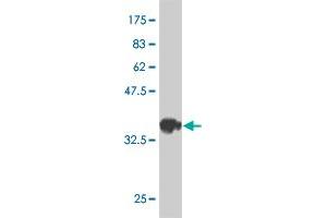 Western Blot detection against Immunogen (37. (FGFR1OP2 antibody  (AA 62-169))