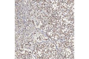IHC analysis of SFXN5 using anti-SFXN5 antibody (ABIN7601388). (Sideroflexin 5 antibody  (AA 34-340))