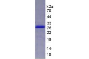 SDS-PAGE analysis of Human DVL2 Protein.