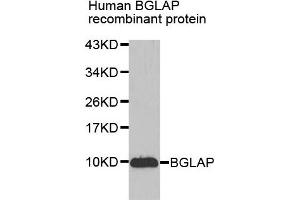 Western blot analysis of extracts of Human BGLAP recombinant protein, using BGLAP antibody. (Osteocalcin antibody)