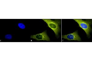 Immunocytochemistry/Immunofluorescence analysis using Rabbit Anti-Rab4 Polyclonal Antibody (ABIN361840 and ABIN361841). (Rab4 antibody  (C-Term))