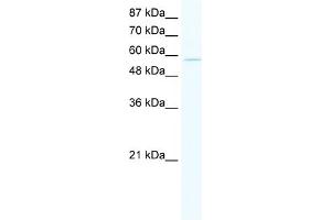 WB Suggested Anti-ZNF559 Antibody Titration:  5.