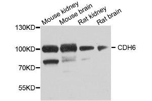 Western blot analysis of extracts of various cell lines, using CDH6 antibody. (CDH6 antibody  (AA 1-250))