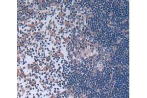 Used in DAB staining on fromalin fixed paraffin- embedded Kidney tissue (Leupaxin antibody  (AA 1-208))